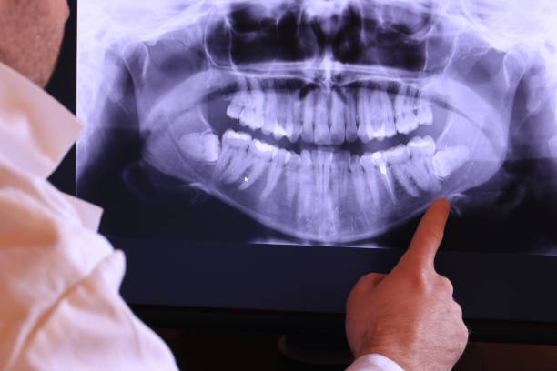 Best Emergency Root Canal Treatment in Roslyn Estates, NY