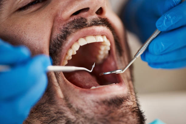 Best Emergency Dentist for Knocked-Out Tooth in Roslyn Estates, NY