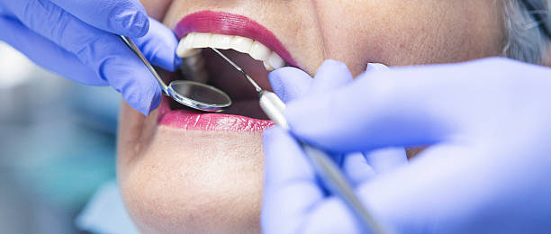 Best Broken or Cracked Tooth Emergency Dentist in Roslyn Estates, NY